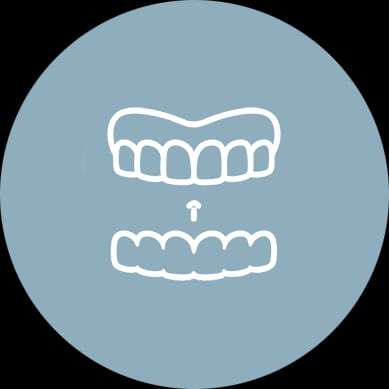 Clear Aligners