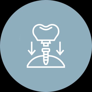 Endodontic Care (Root Canals)