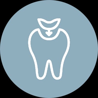 Fillings and Restorations