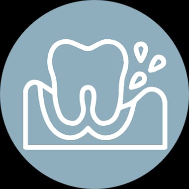 Gum Disease Treatment